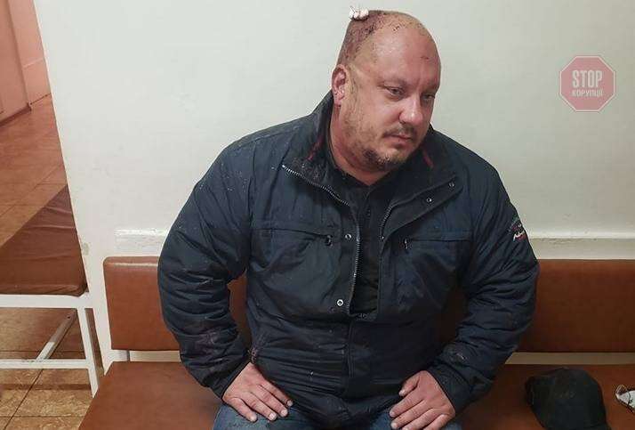 &quot;Це був замах на вбивство&quot;, — активіст з Дніпра розкрив подробиці нападу