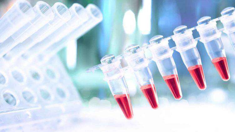 Украинские тесты для определения коронавируса ждут уже на этой неделе