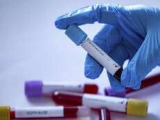 В Украине зафиксировано еще 11 случаев коронавирусной болезни