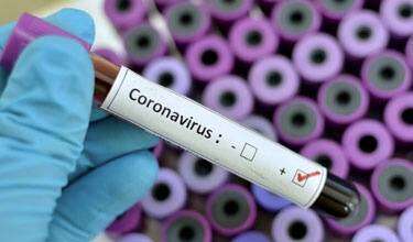 Протидія розповсюдженню коронавірусу у Дніпрі: підсумки тижня