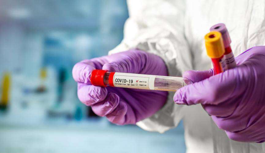Как работает инфекционная больница Днепра в период эпидемии коронавируса (ФОТО, ВИДЕО)