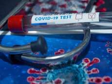 В Днепре новые случаи заражения COVID-19: данные на утро субботы