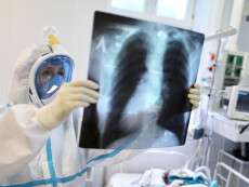 2020-05-23T202004Z_681856171_RC2KUG9NJ73K_RTRMADP_3_HEALTH-CORONAVIRUS-RUSSIA-CASES (1).JPG
