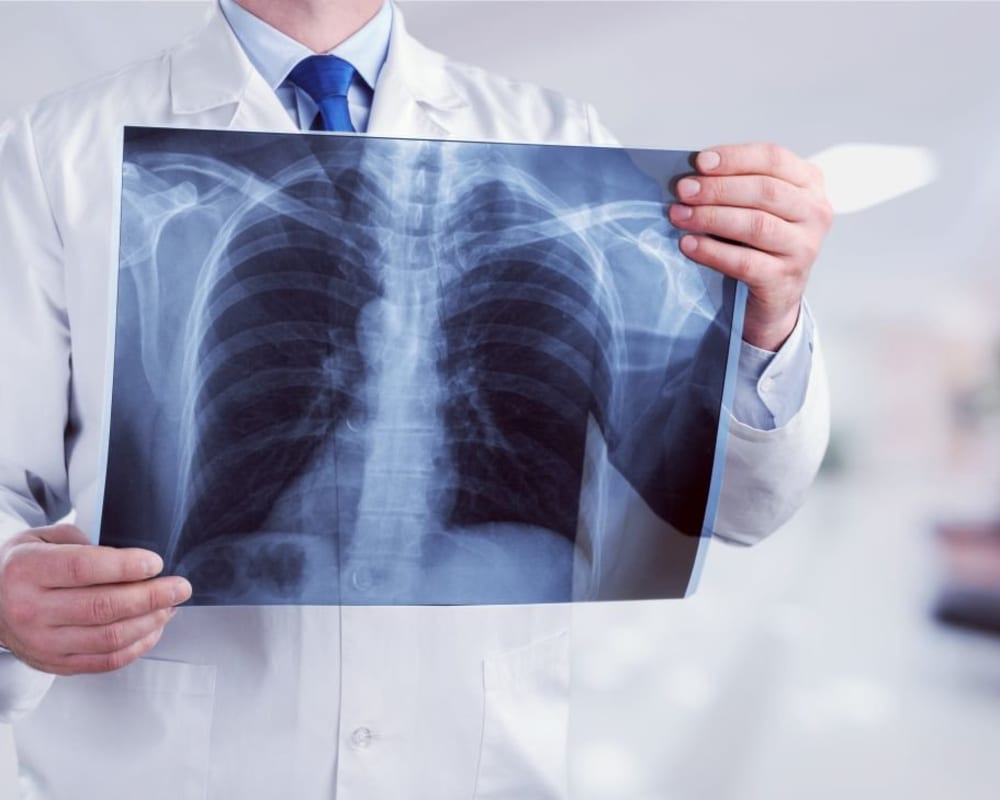 В торговых центрах Днепра можно сделать бесплатную флюорографию (РАСПИСАНИЕ)