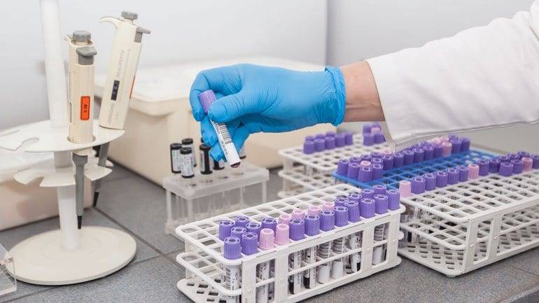 В каких районах Днепропетровской области до сих пор не зафиксировано ни одного случая заражения COVID-19