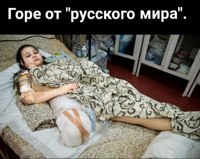 “Русский мир”, который несёт горе: 15-летняя Маша из Полог в результате обстрела потеряла ногу