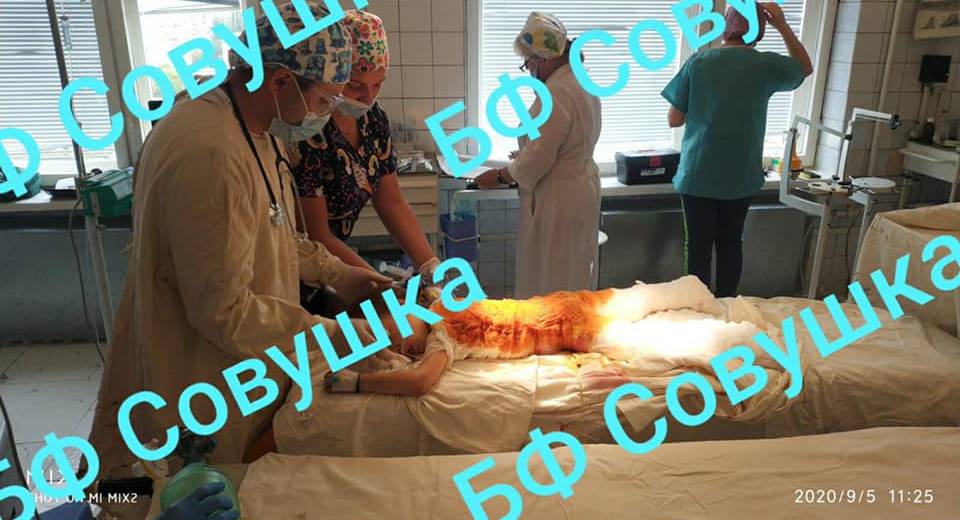 “Состояние крайне тяжелое, глубокие ожоги пламенем, до самых мышц”: в Днепре спасают малышку