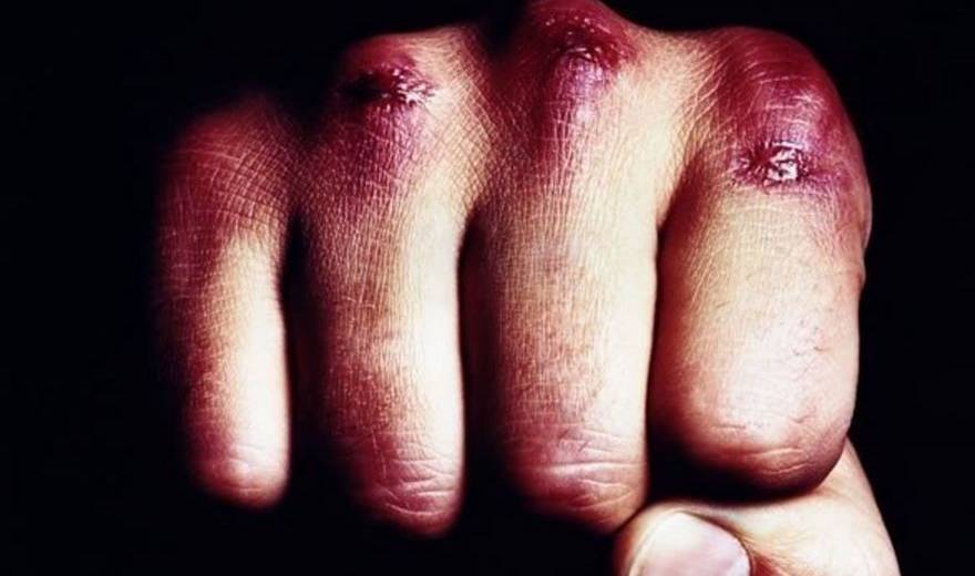 В Днепре 16-летнего парня, избившего подростка до смерти, посадили на 11 лет