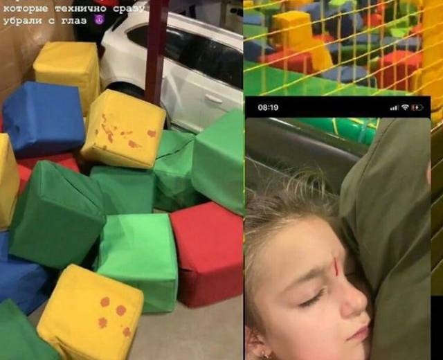 В Днепре девочка рассекла лицо на батуте