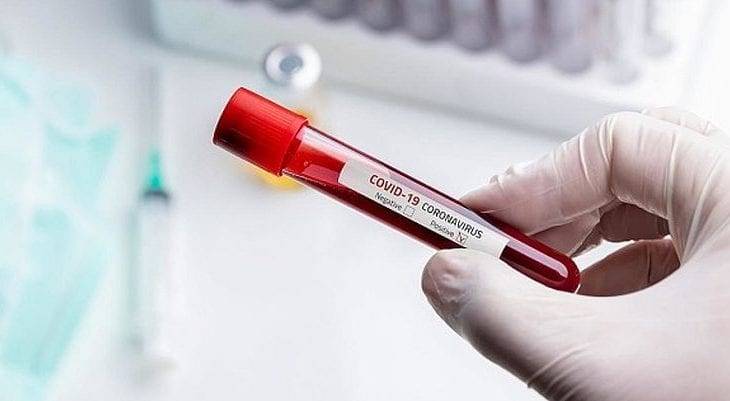 В Днепре резко выросло количество новых случаев COVID-19: свежие данные