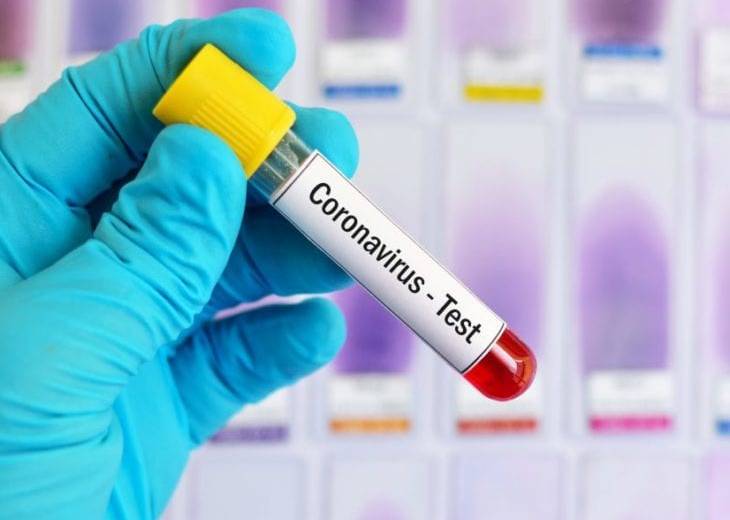 COVID-19 в Днепре: свежая статистика на утро субботы