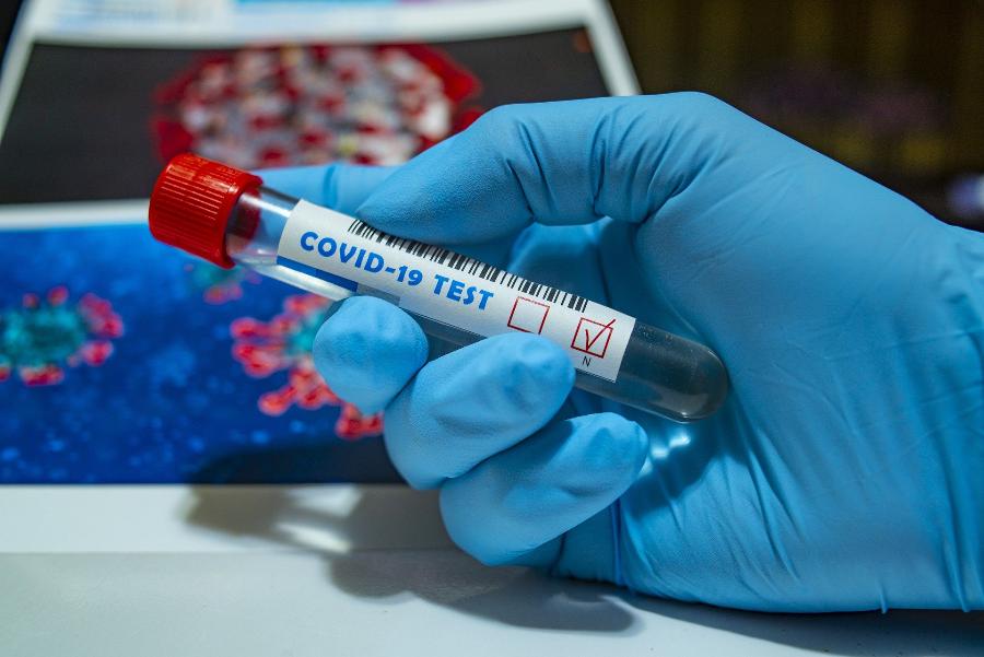 Як захистити себе від повернення COVID-19: поради для жителів Дніпра