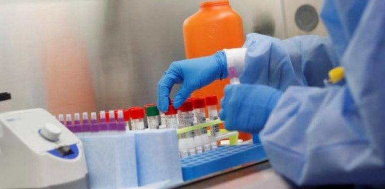 ДнепрОГА закупила российские тесты на коронавирус по завышенной цене