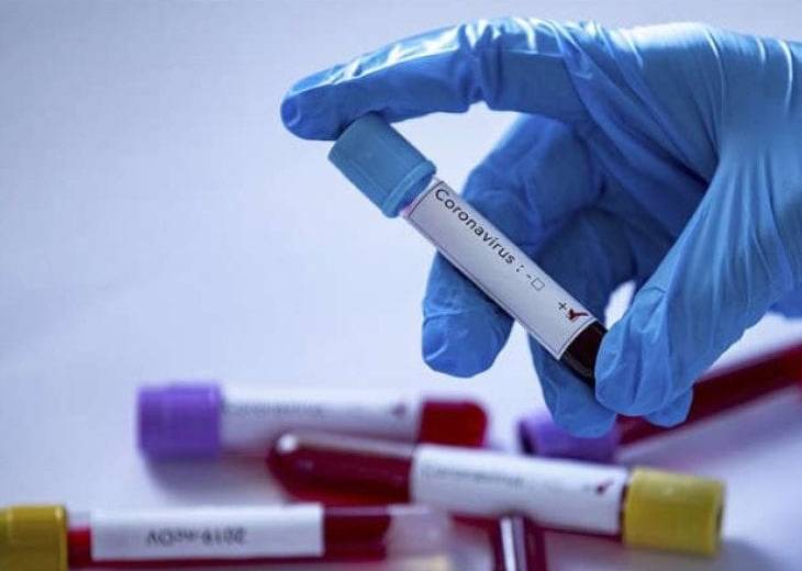 В Украине зафиксировано еще 11 случаев коронавирусной болезни