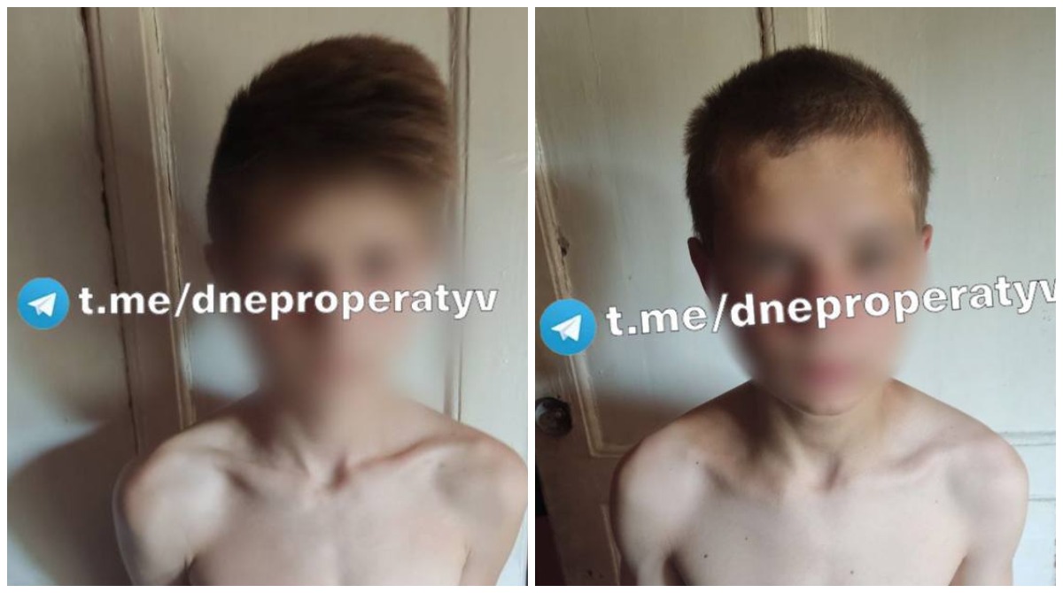 Стало відомо, чому в Дніпрі двічі шукали підлітків, які втекли з лікарні. Фото