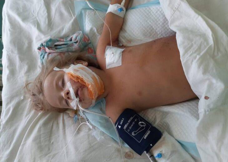 Малышка, которая выпала из окна 5 этажа остро нуждается в помощи