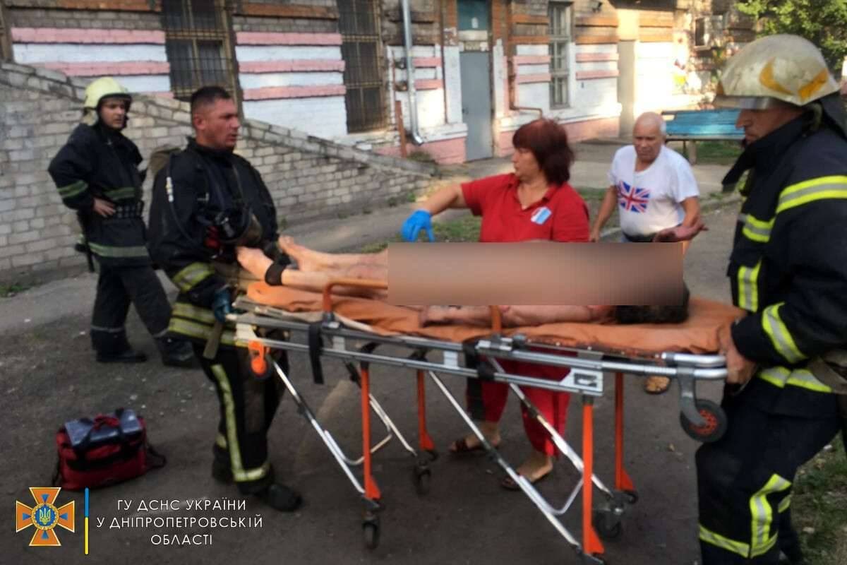 Под Днепром загорелась квартира: у хозяйки ожоги 98% тела