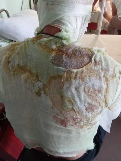 Лікарі Дніпра врятували життя 40-річного військового, який у бою отримав важкі поранення
