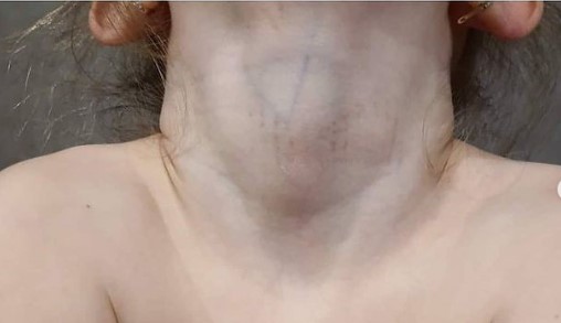Гематомы и следы удушения: в сети рассказали о новых жертвах стоматолога-садистки Инны Кравчук (ФОТО)