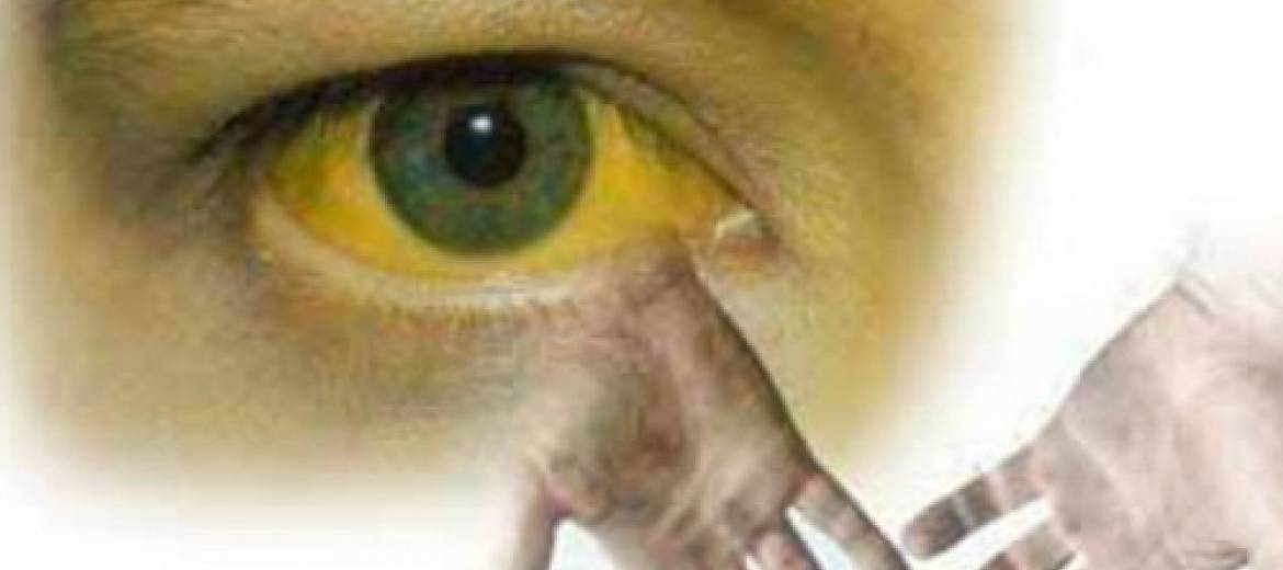 В одной из школ Днепра зафиксировали гепатит