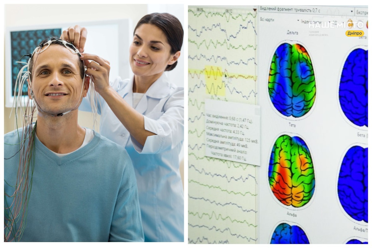 Як перевірити здоров'я мозку у Дніпрі: місця та вартість ЕЕГ