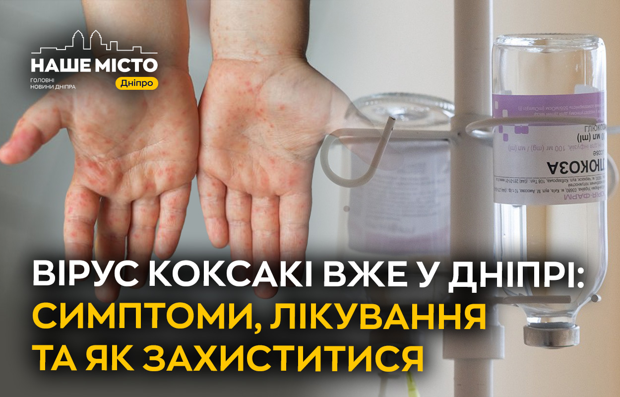 Вірус Коксакі зафіксовано у Дніпрі: як уберегтися