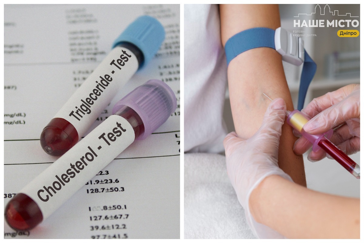 Де і за скільки можна здати аналіз на холестерин у Дніпрі?