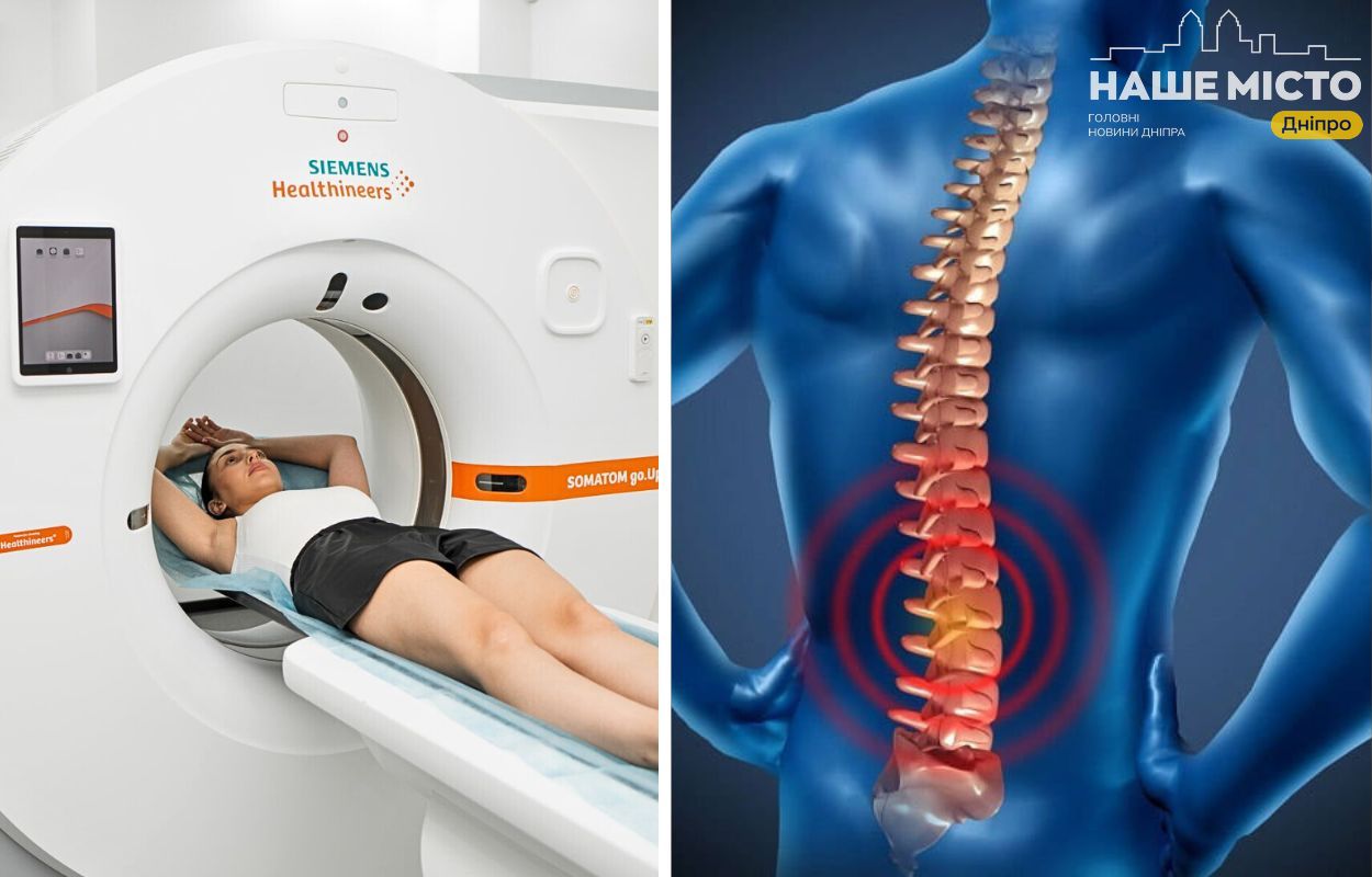Діагностика хребта в Дніпрі: де зробити КТ та які ціни