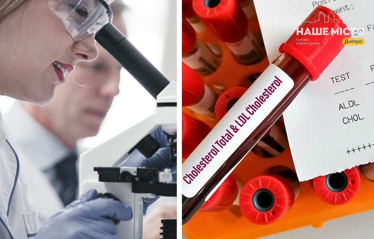 Як і де перевірити рівень холестерину у Дніпрі?