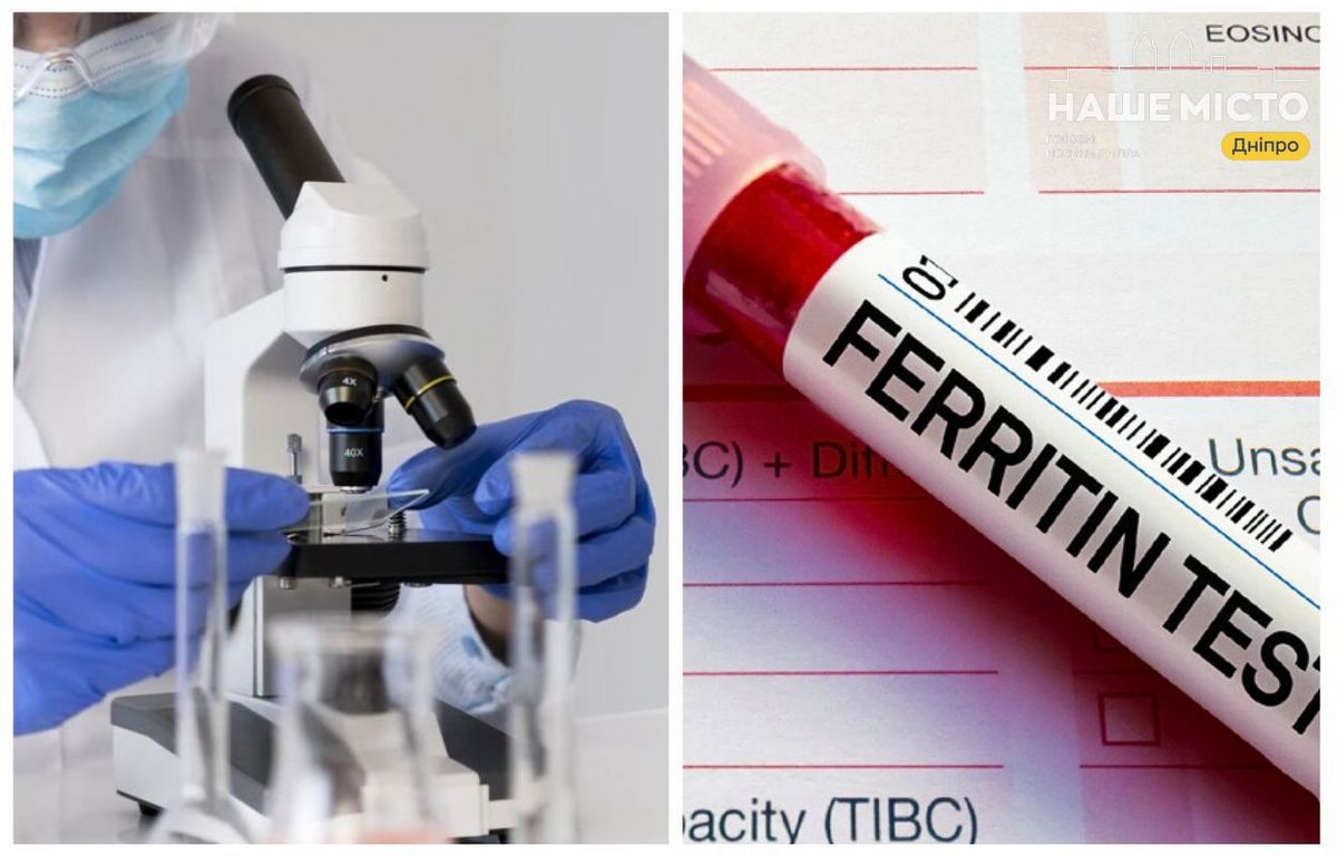 Де зробити аналіз на феритин у Дніпрі: адреси та ціни