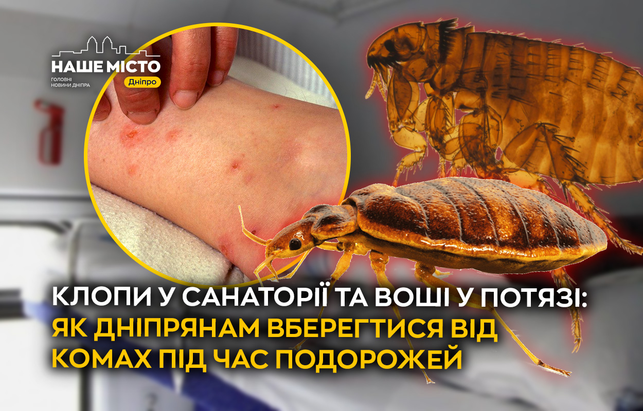 Як уникнути укусів клопів і вошей під час подорожей у Дніпрі