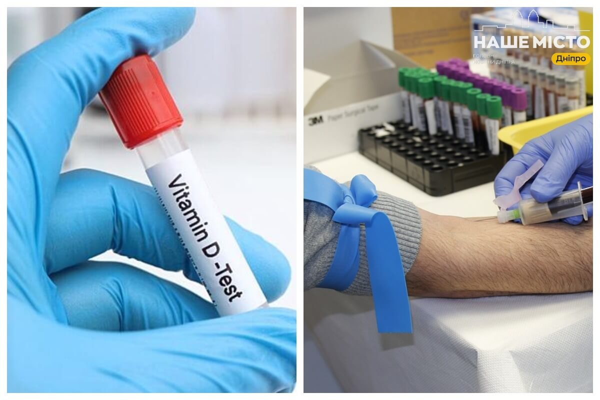 Де у Дніпрі здати аналіз на вітамін D і скільки це коштує
