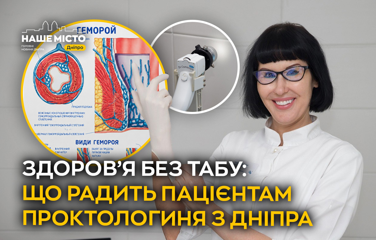 Проктологиня з Дніпра розвінчує міфи та радить щодо лікування геморою